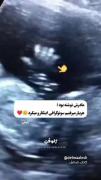 این خیلی خوب بود😄😍. ‌____
