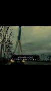 دارم وانمود میکنم درد نداره اما... 