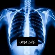 ☠️ـ........................... 