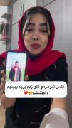 عکس شوهرشو تتو زده مو نمیزنه با عکس🥹❤️