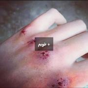 8 بهمن 1403 ... چیزی نیست خوبم 🙂💔