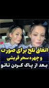 اتفاق تلخ برای صورت و چهره #سحر_قریشی 