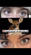 ؋ـرم چشم هات از نظر בوستت🫀😑‌‌‌‌
