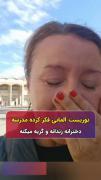 بیچارـہ گریش گرـ؋ـت😂🎀‌‌‌‌‌‌‌‌‌
