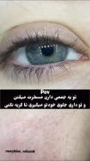 سخت ترین لحظه. ) .