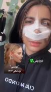 غوز بینی ترند ۲۰۲۶ ...‌ ‌ ‌‌ ‌‌‌‌ 