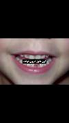 `اون دختَر شِیطون هَنوز درون توعه`🎀😇