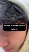 تو زشت نیستی فقط باید دوربین رو عقب تر بگیری