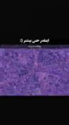 حتی بیشتر از اینی که هست دوست دارم عزیزم ❤️