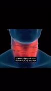 حسی که موقع دعوا دارم 💔🖤😭‌‌‌‌