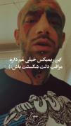 این ریمیکس خیلی غم داره مراقب دل شکستت باش:)🥲💔