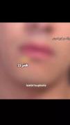 ادیت دیدنی از پیرسینگ لب جونگکوک عضو بی‌تی‌اس