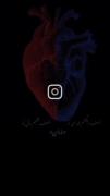 روز مادر مبارک ❤️‍🩹⁦(⁠*⁠_⁠*⁠)⁩